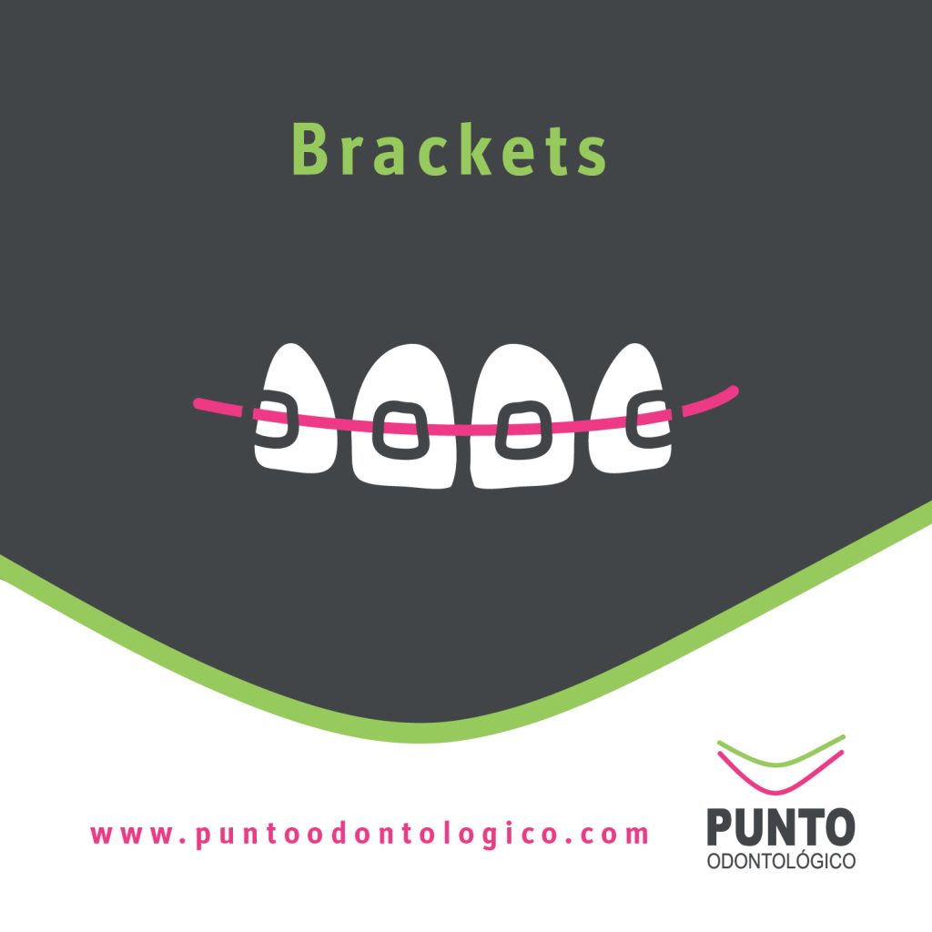 buscas brackets en Montevideo? precio de instalación de brackets
